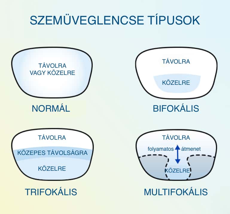 Multifokális lencsék összehasonlítás